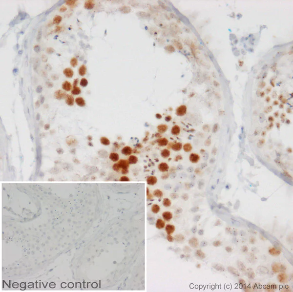 Immunohistochemistry (Formalin/PFA-fixed paraffin-embedded sections) - Anti-Coilin antibody [IH10] (AB87913)