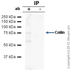 Immunoprecipitation - Anti-Coilin antibody [IH10] (AB87913)