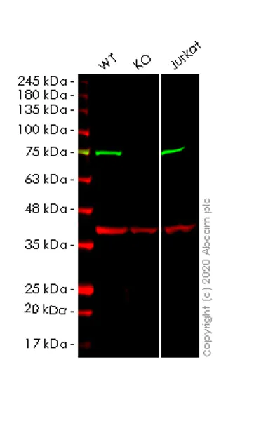 Western blot - Anti-Coilin antibody [IH10] (AB87913)