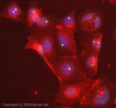 Immunocytochemistry/ Immunofluorescence - Anti-Coilin antibody [Pdelta] (AB11822)
