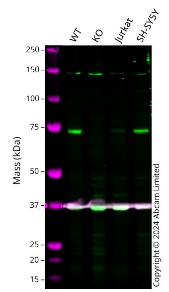 Western blot - Anti-Coilin antibody [Pdelta] (AB11822), expandable thumbnail