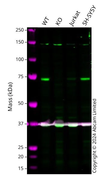 Western blot - Anti-Coilin antibody [Pdelta] (AB11822)