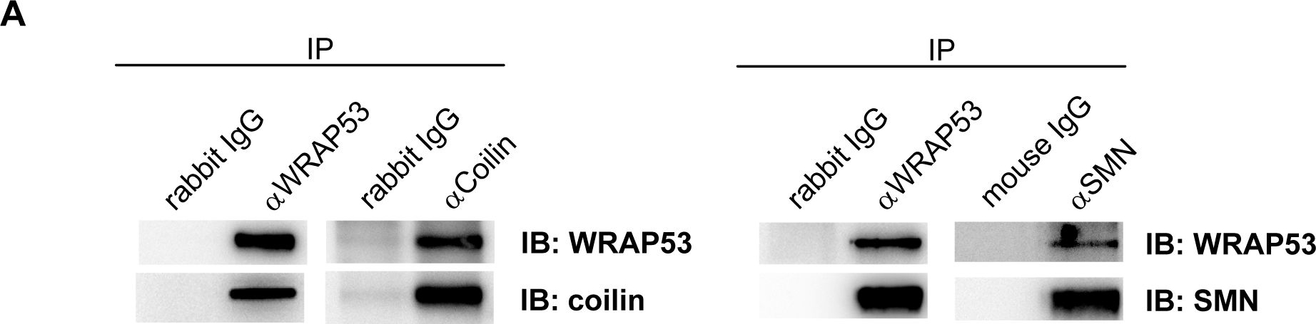 Western blot - Anti-Coilin antibody [Pdelta] (AB11822), expandable thumbnail