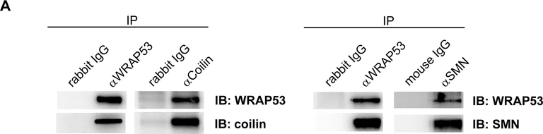 Western blot - Anti-Coilin antibody [Pdelta] (AB11822)