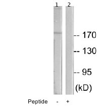 Western blot - Anti-COL11A1 antibody (AB64883), expandable thumbnail