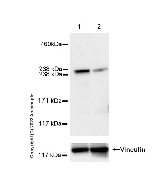 Western blot - Anti-COL11A1 antibody [EPR24327-8] (AB270946)