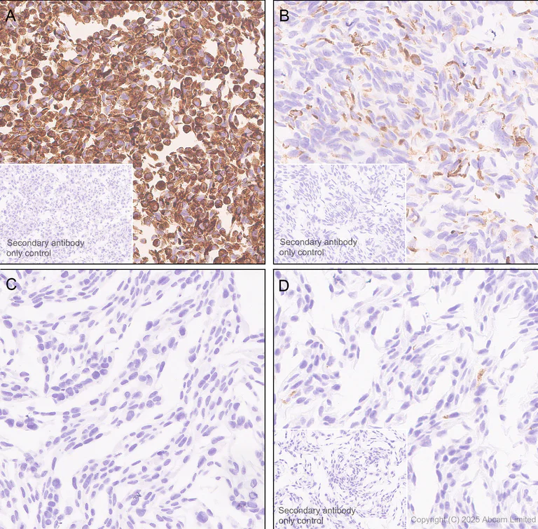 Immunohistochemistry (Formalin/PFA-fixed paraffin-embedded sections) - Anti-COL11A1 antibody [EPR28734-175] (AB324519)