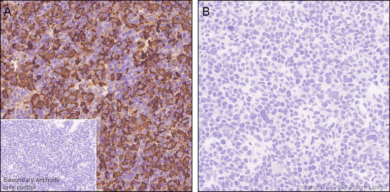 Immunohistochemistry (Formalin/PFA-fixed paraffin-embedded sections) - Anti-COL11A1 antibody [EPR28734-175] (AB324519)