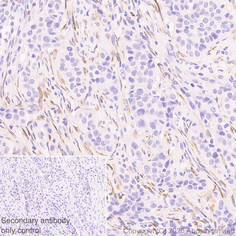 Immunohistochemistry (Formalin/PFA-fixed paraffin-embedded sections) - Anti-COL11A1 antibody [EPR28734-175] (AB324519)
