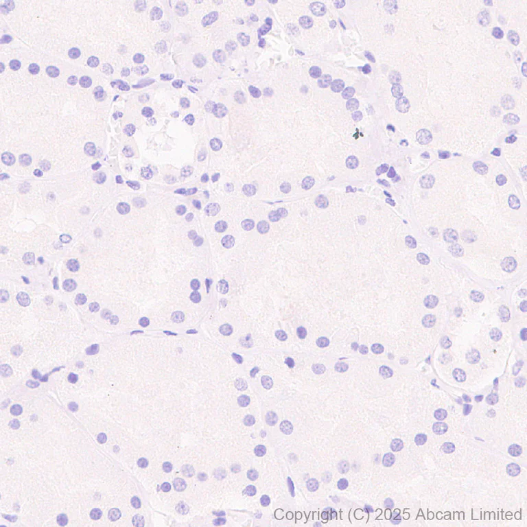 Immunohistochemistry (Formalin/PFA-fixed paraffin-embedded sections) - Anti-COL11A1 antibody [EPR28734-175] (AB324519)