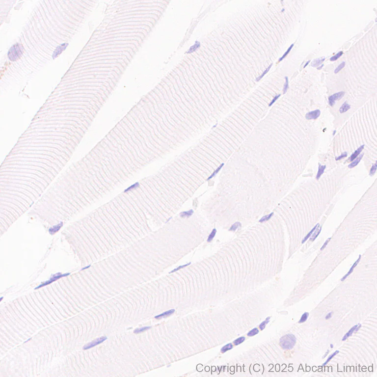 Immunohistochemistry (Formalin/PFA-fixed paraffin-embedded sections) - Anti-COL11A1 antibody [EPR28734-175] (AB324519)