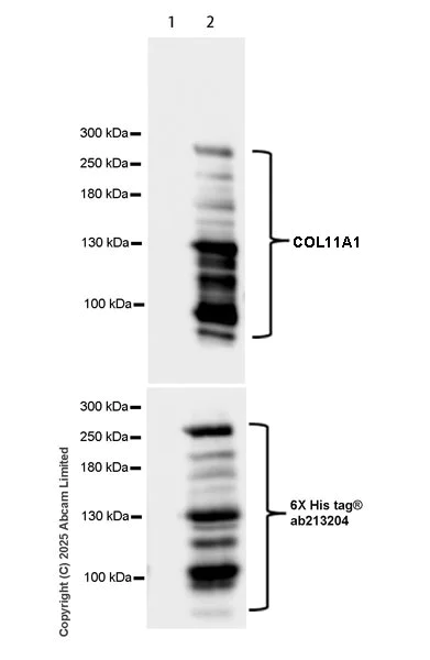 Western blot - Anti-COL11A1 antibody [EPR28734-175] (AB324519)