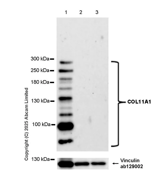 Western blot - Anti-COL11A1 antibody [EPR28734-175] (AB324519)