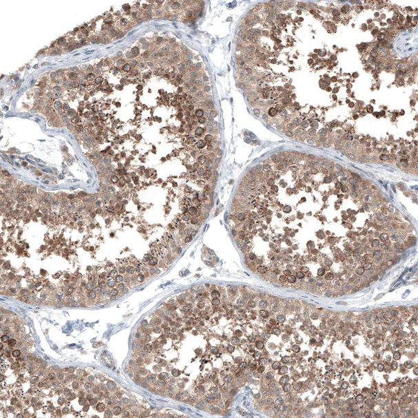 Immunohistochemistry (Formalin/PFA-fixed paraffin-embedded sections) - Anti-COL12A1 antibody (AB121304)