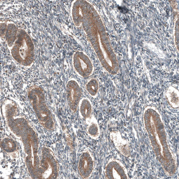 Immunohistochemistry (Formalin/PFA-fixed paraffin-embedded sections) - Anti-COL12A1 antibody (AB121304)