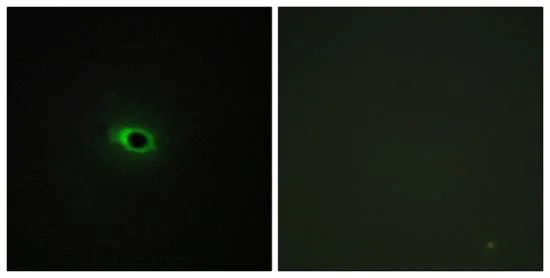 Immunocytochemistry/ Immunofluorescence - Anti-COL12A1 antibody (AB196619)
