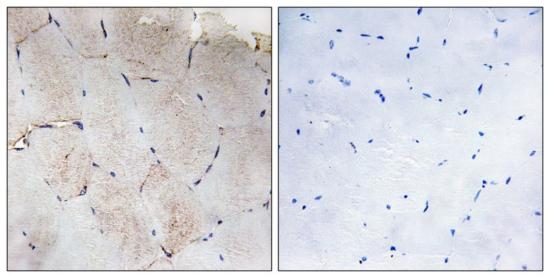 Immunohistochemistry (Formalin/PFA-fixed paraffin-embedded sections) - Anti-COL12A1 antibody (AB196619)