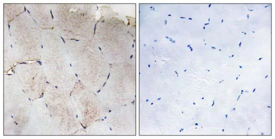 Immunohistochemistry (Formalin/PFA-fixed paraffin-embedded sections) - Anti-COL12A1 antibody (AB196619)