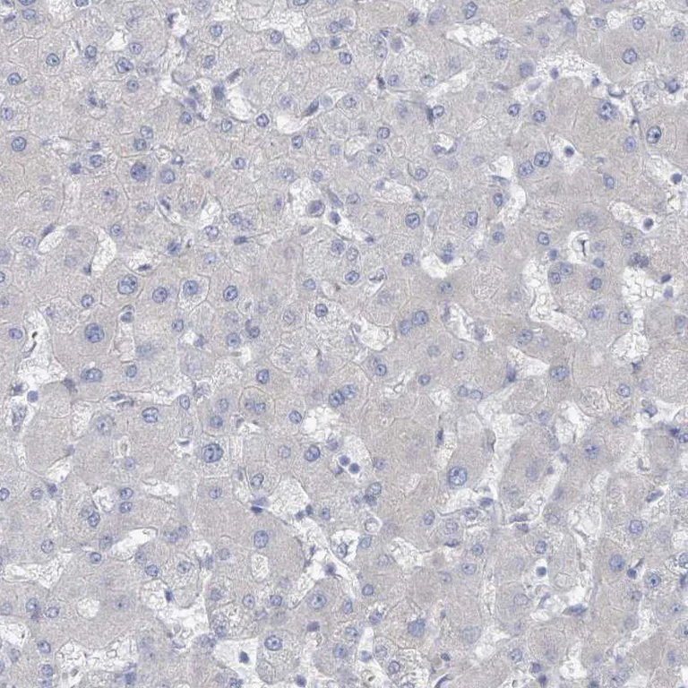 Immunohistochemistry (Formalin/PFA-fixed paraffin-embedded sections) - Anti-COL13A1 antibody (AB254926)
