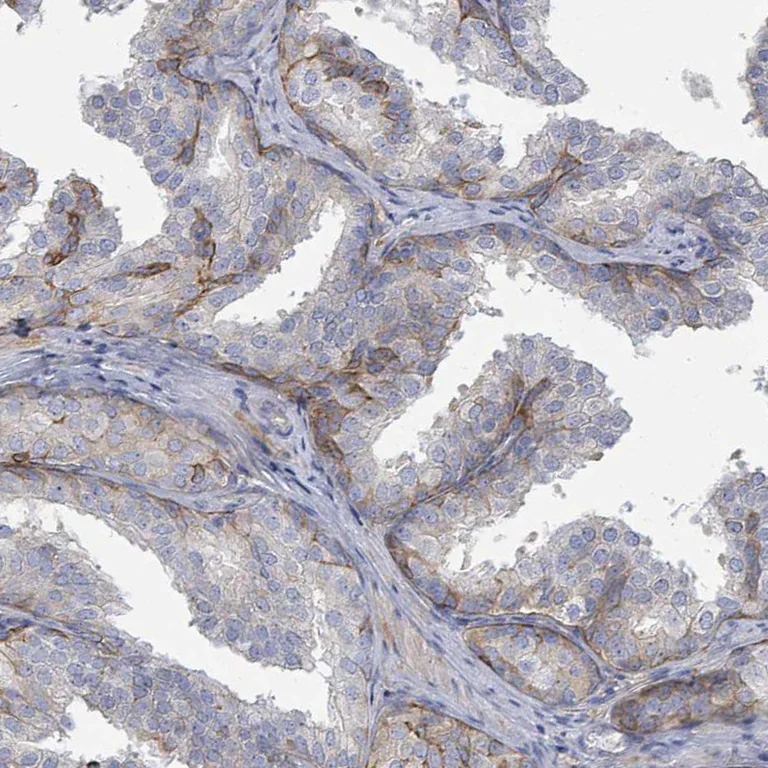 Immunohistochemistry (Formalin/PFA-fixed paraffin-embedded sections) - Anti-COL13A1 antibody (AB254926)
