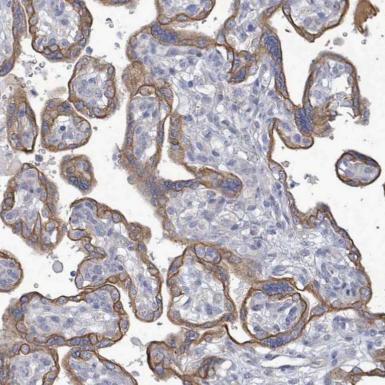 Immunohistochemistry (Formalin/PFA-fixed paraffin-embedded sections) - Anti-COL13A1 antibody (AB254926)