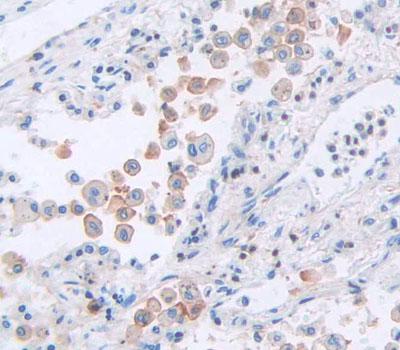 Immunohistochemistry (Formalin/PFA-fixed paraffin-embedded sections) - Anti-COL16A1 antibody - C-terminal (AB231044)