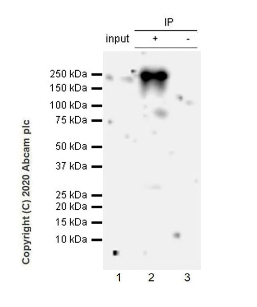 Immunoprecipitation - Anti-COL18A1 antibody [EPR23481-21] (AB275746)