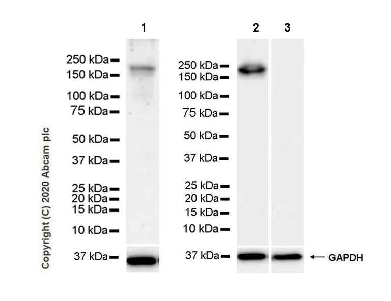 Western blot - Anti-COL18A1 antibody [EPR23481-21] (AB275746)