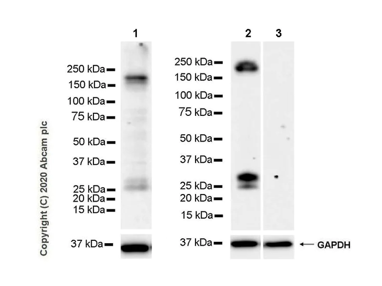 Western blot - Anti-COL18A1 antibody [EPR23481-240] (AB275390)