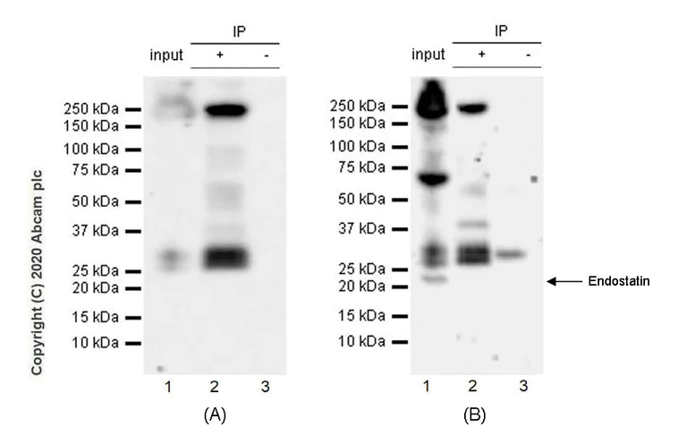 Immunoprecipitation - Anti-COL18A1 antibody [EPR23481-240] - BSA and Azide free (AB275394)