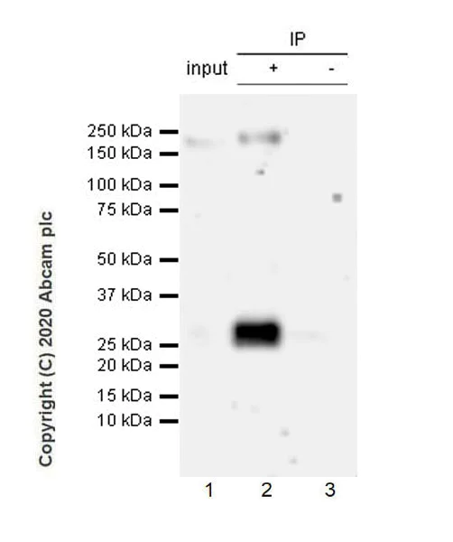 Immunoprecipitation - Anti-COL18A1 antibody [EPR23481-240] - BSA and Azide free (AB275394)