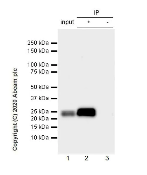 Immunoprecipitation - Anti-COL18A1 antibody [EPR23481-240] - BSA and Azide free (AB275394)