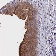 Immunohistochemistry (Formalin/PFA-fixed paraffin-embedded sections) - Anti-COL19A1 antibody (AB122793)