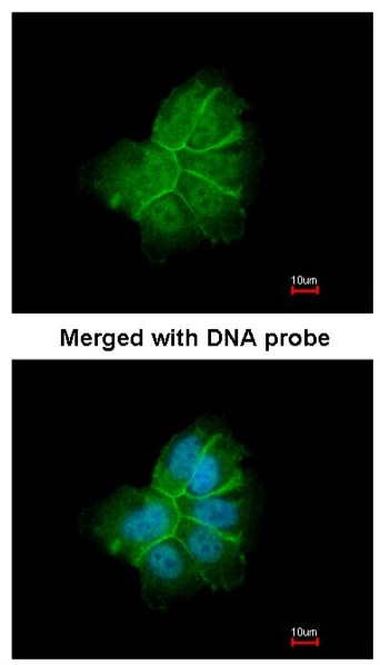 Immunocytochemistry/ Immunofluorescence - Anti-COL1A2 antibody (AB96723), expandable thumbnail