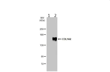 Western blot - Anti-COL1A2 antibody (AB96723)