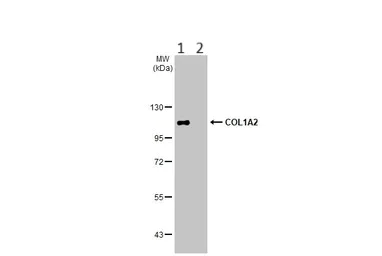Western blot - Anti-COL1A2 antibody (AB96723)