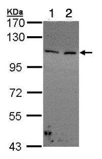 Western blot - Anti-COL1A2 antibody (AB96723), expandable thumbnail