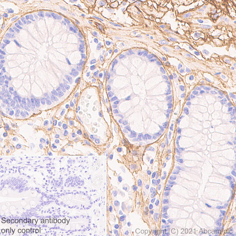 Immunohistochemistry (Formalin/PFA-fixed paraffin-embedded sections) - Anti-COL1A2 antibody [EPR24262-52] (AB270994)