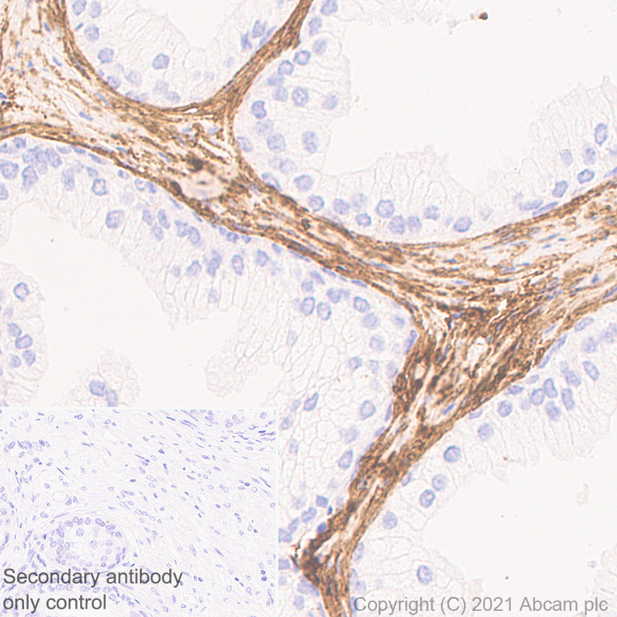 Immunohistochemistry (Formalin/PFA-fixed paraffin-embedded sections) - Anti-COL1A2 antibody [EPR24262-52] - BSA and Azide free (AB280084)