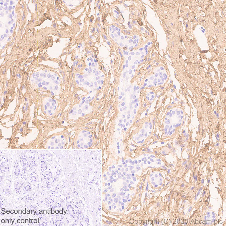 Immunohistochemistry (Formalin/PFA-fixed paraffin-embedded sections) - Anti-COL1A2 antibody [EPR27415-30] - BSA and Azide free (AB308456)