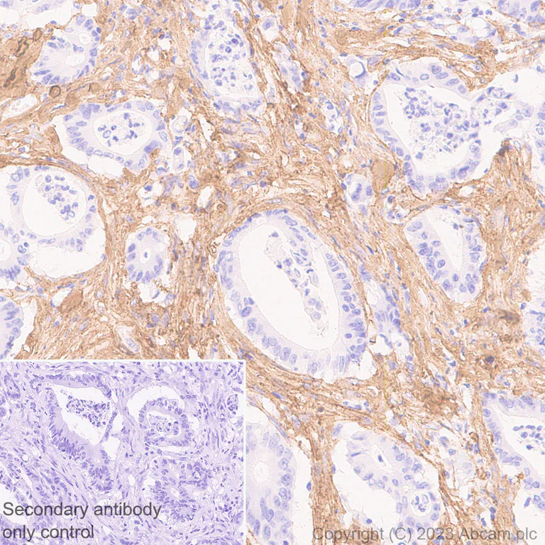 Immunohistochemistry (Formalin/PFA-fixed paraffin-embedded sections) - Anti-COL1A2 antibody [EPR27415-30] - BSA and Azide free (AB308456)
