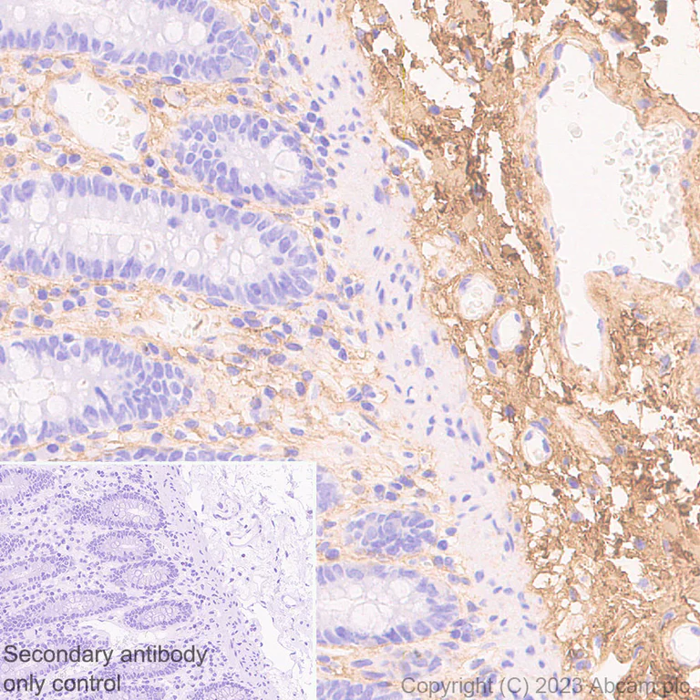 Immunohistochemistry (Formalin/PFA-fixed paraffin-embedded sections) - Anti-COL1A2 antibody [EPR27415-30] - BSA and Azide free (AB308456)