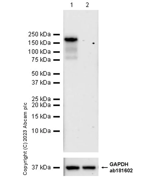 Western blot - Anti-COL1A2 antibody [EPR27415-30] - BSA and Azide free (AB308456)