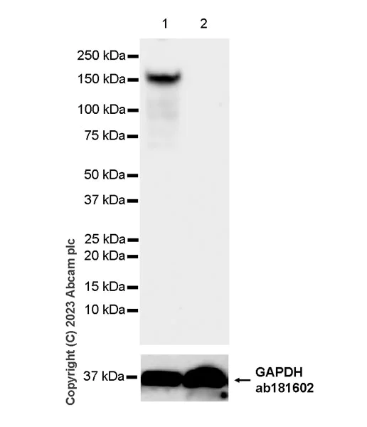 Western blot - Anti-COL1A2 antibody [EPR27415-30] - BSA and Azide free (AB308456)