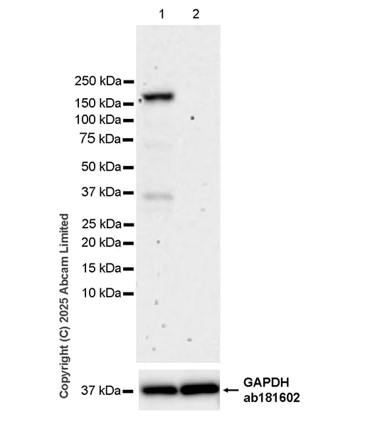 Western blot - Anti-COL1A2 antibody [EPR29717-534] (AB323563)