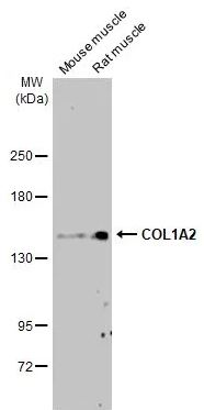 Western blot - Anti-COL1A2 antibody [HL2049] (AB308221), expandable thumbnail