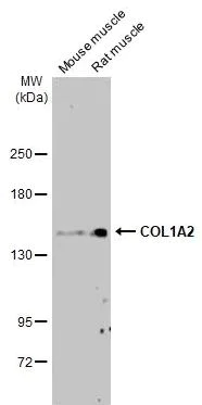 Western blot - Anti-COL1A2 antibody [HL2049] (AB308221)