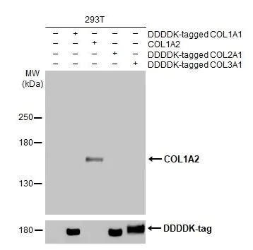 Western blot - Anti-COL1A2 antibody [HL2049] (AB308221)