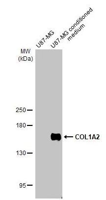Western blot - Anti-COL1A2 antibody [HL2049] (AB308221), expandable thumbnail