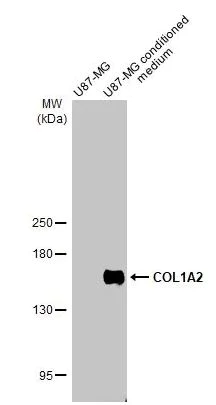 Western blot - Anti-COL1A2 antibody [HL2049] (AB308221)